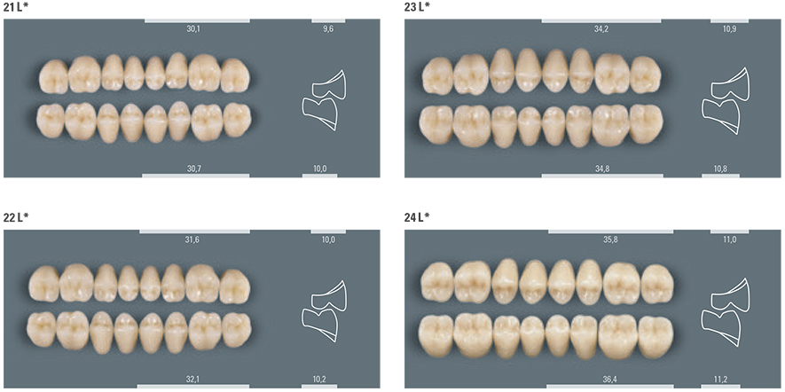 VITA LINGOFORM MOULD CHART
